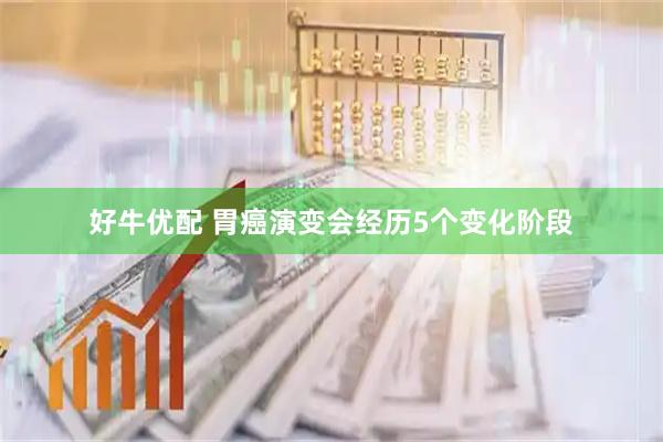 好牛优配 胃癌演变会经历5个变化阶段
